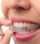A dentist in San Antonio, TX, explains how to get a beautiful, functional smile with Invisalign